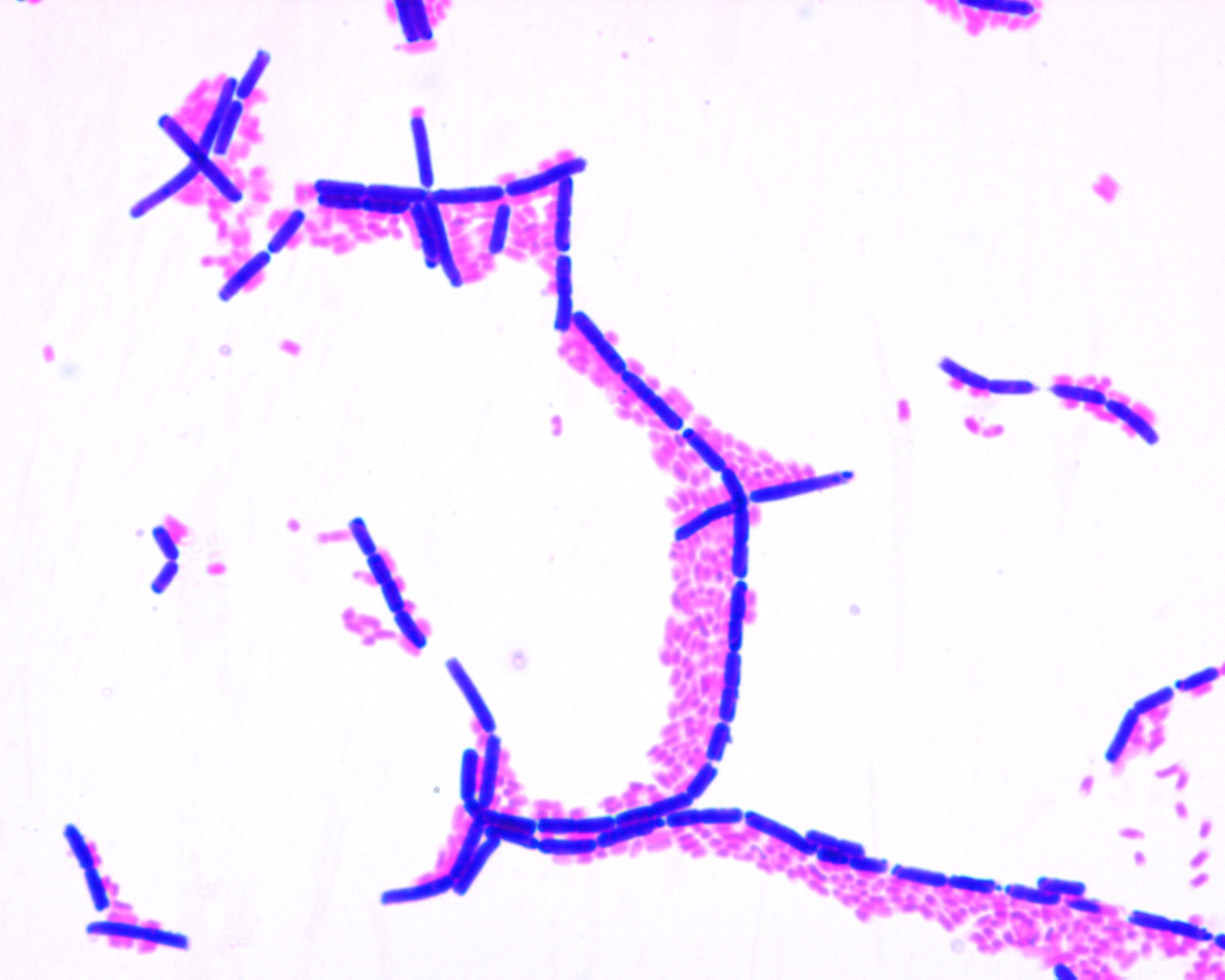 Escherichia Coli