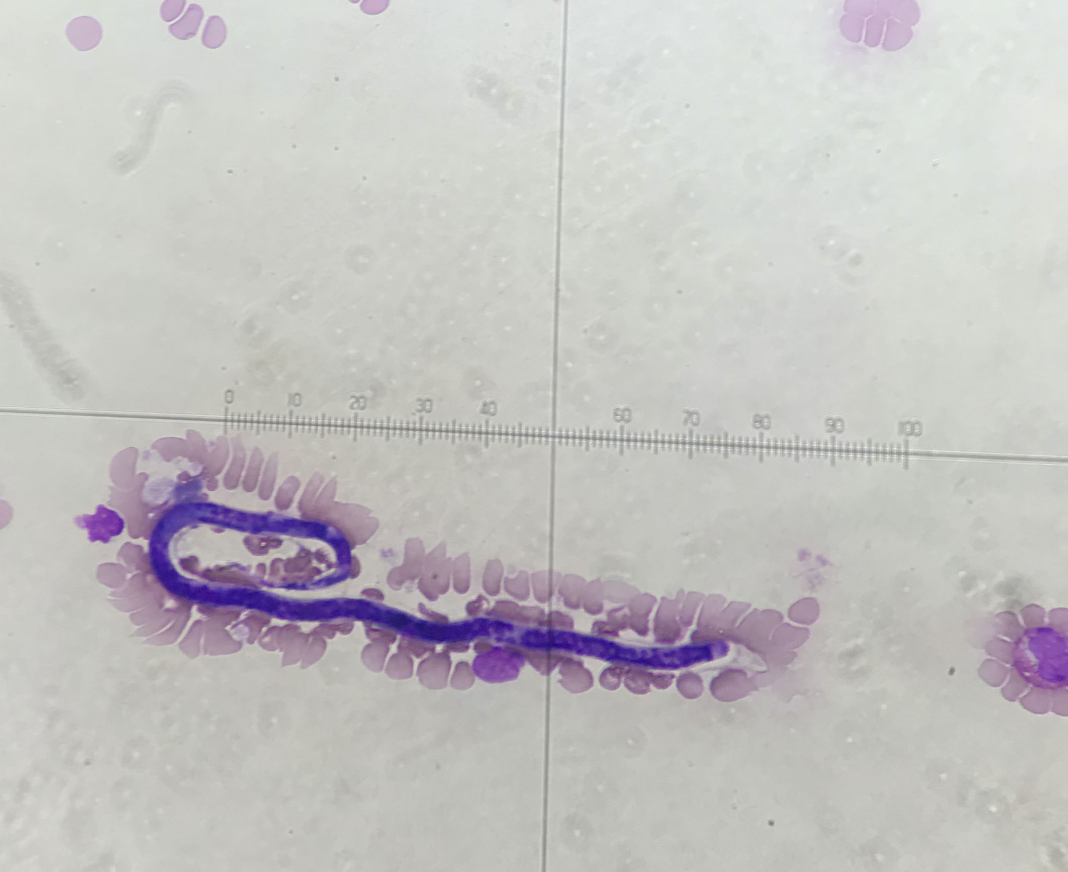 Parasite Filariae