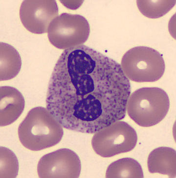 Interesting shape cells - Exclamation Point