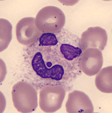 Interesting shape cells - Face