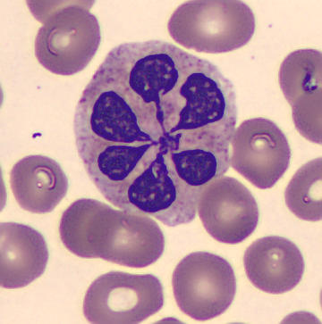 Interesting shape cells - Flower