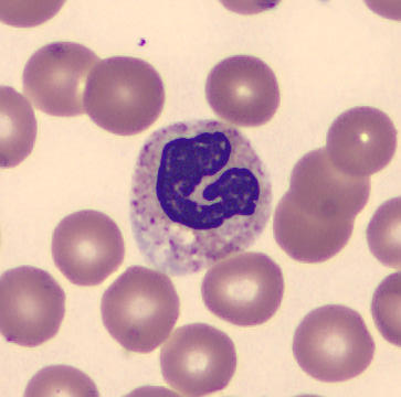 Neutrophil alphabet - G