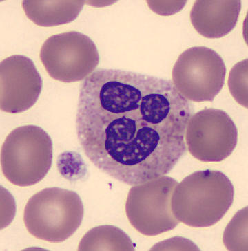 Interesting shape cells - Happy face
