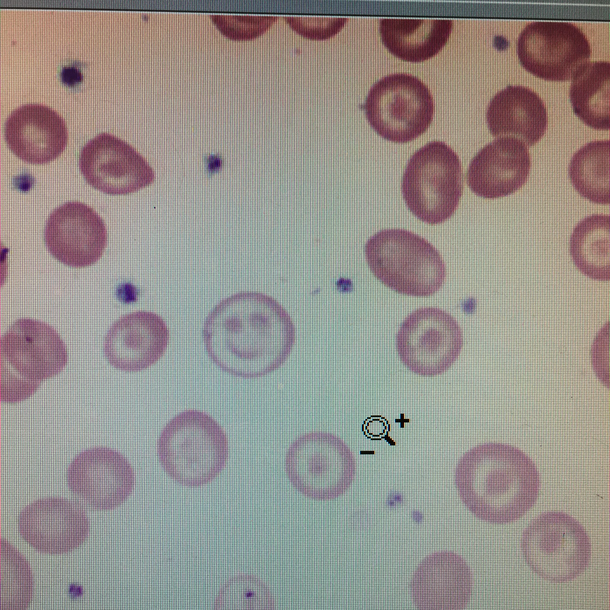 Interesting shape cells - Smiley face