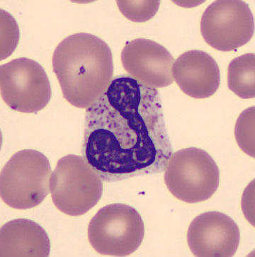 Neutrophil alphabet - J