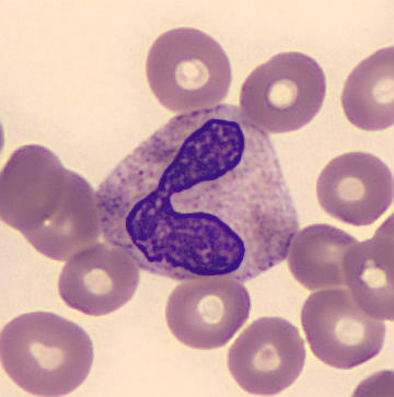 Neutrophil alphabet - L