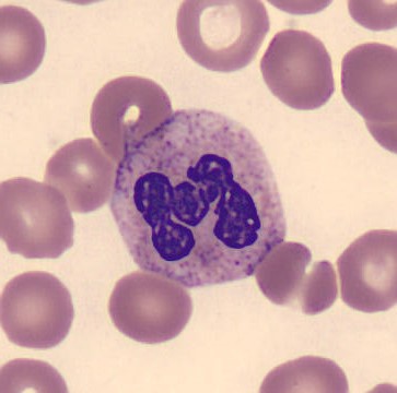 Neutrophil alphabet - M