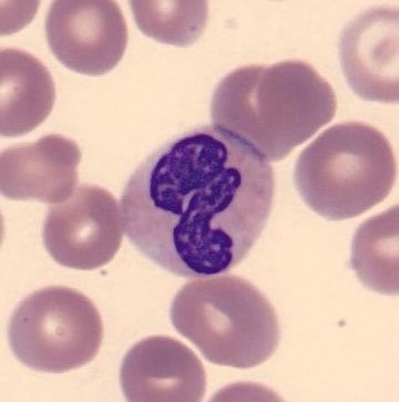 Neutrophil alphabet - P