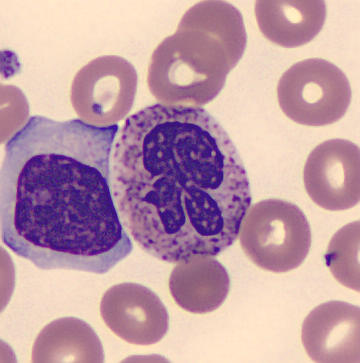 Neutrophil alphabet - R