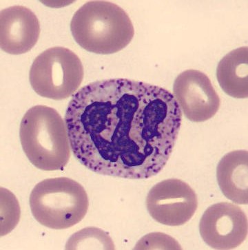 Neutrophil alphabet - W