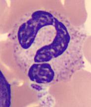 Interesting shape cells - Question mark