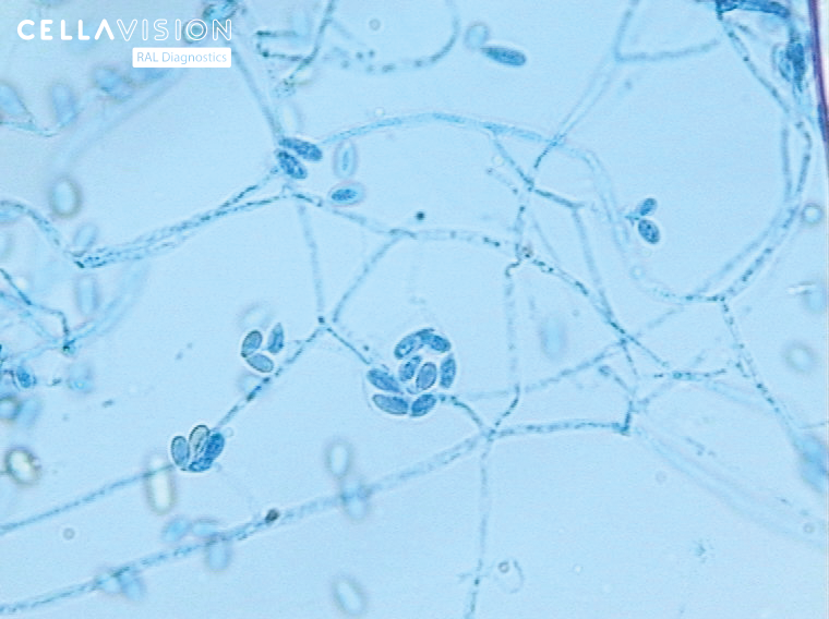 Scedosporium CellaVision RAL Diagnostics