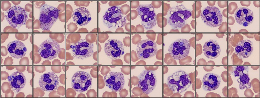 Anaplasmosis cells