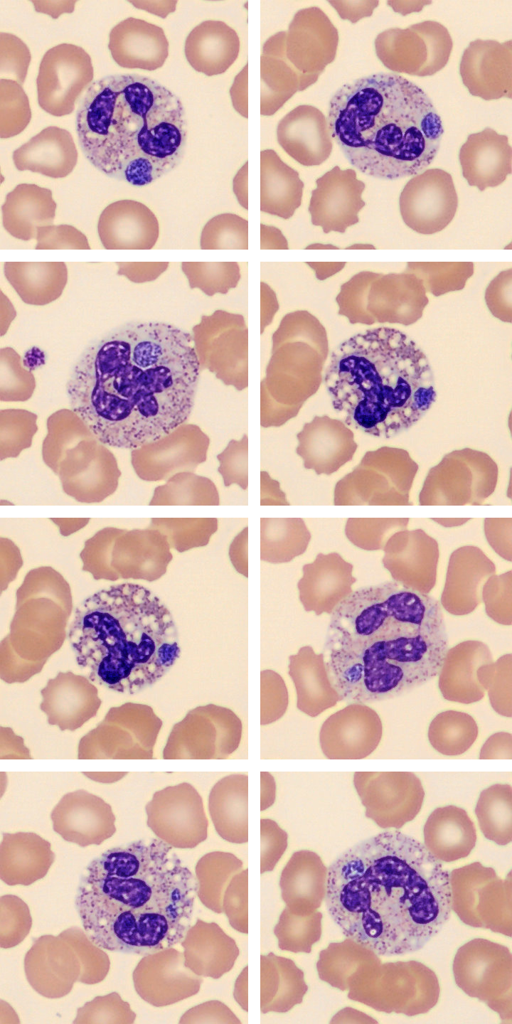 Anaplasmosis cells