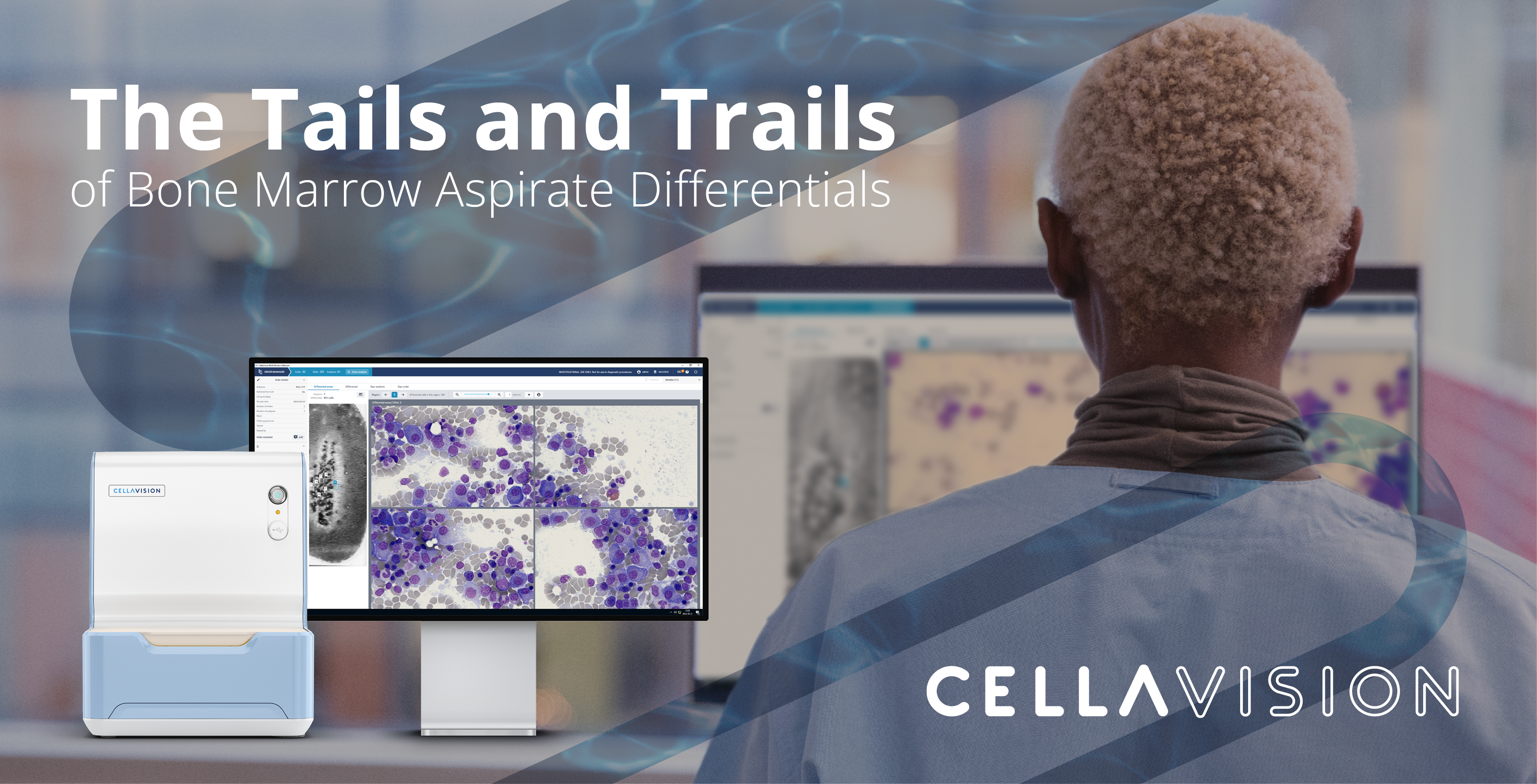 ISLH presentation Bone Marrow Aspirate Differentials