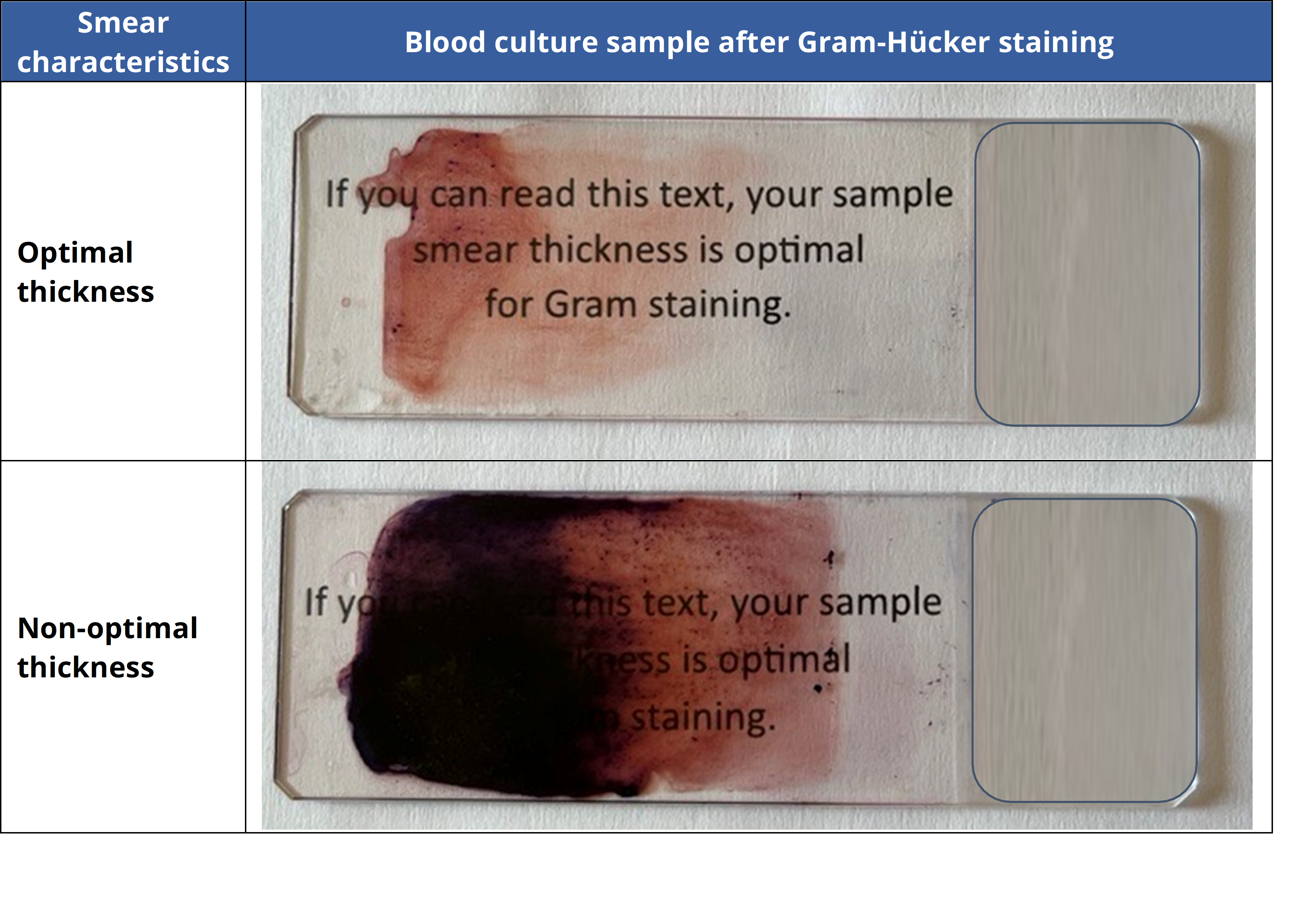 Blood culture sample after Gram-Hücker staining: optimal and non-optimal thickness