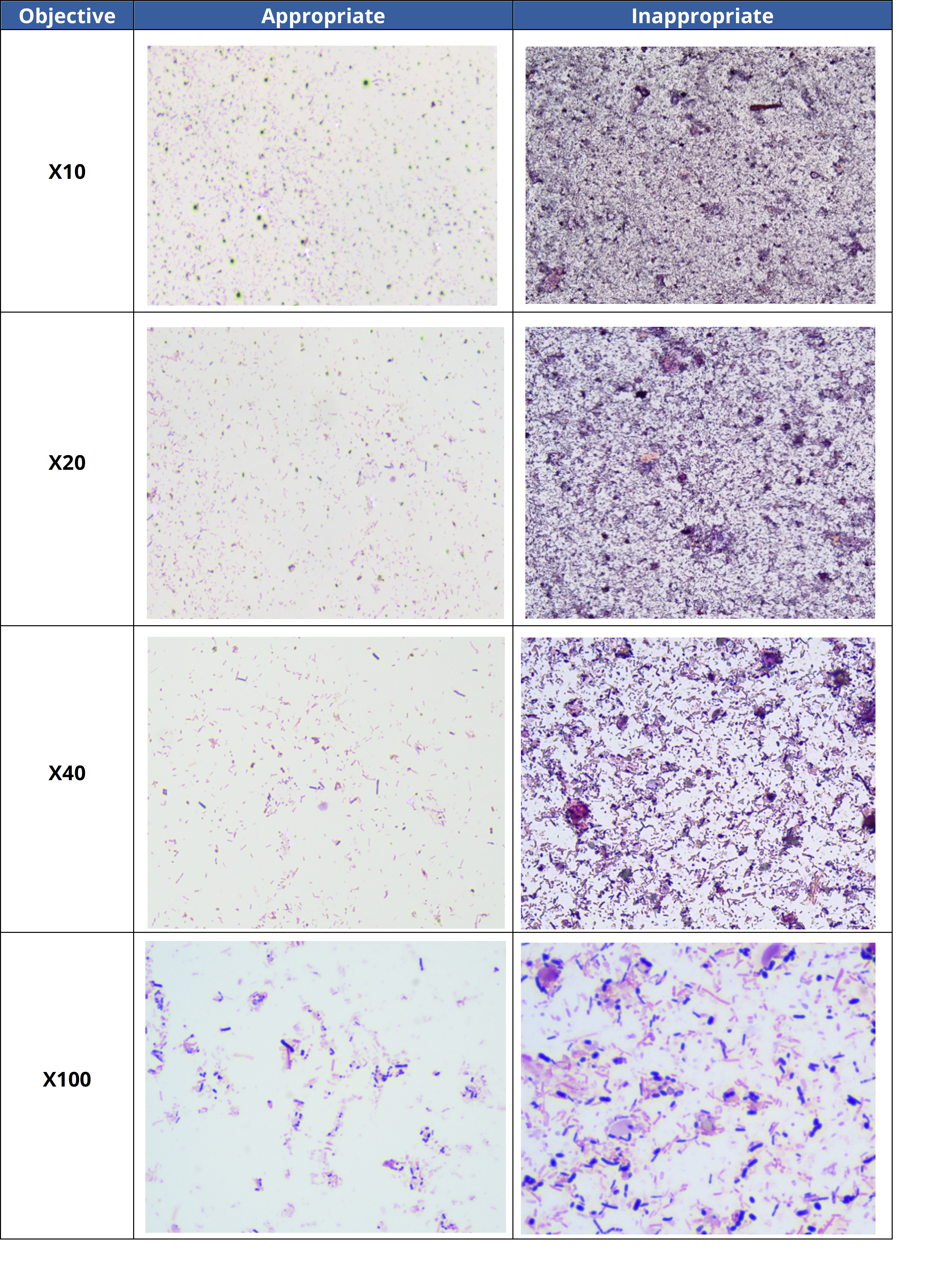 Examples from stool smears of appropriate and inappropriate reading zones on stained slides