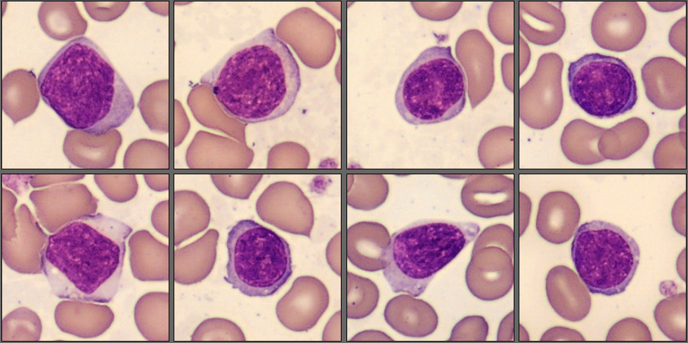 Lymphocytes from the CellaVision Monthly cell challenge May 2025