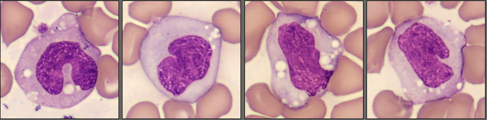 Monocytes monthly cell challenge May 2025