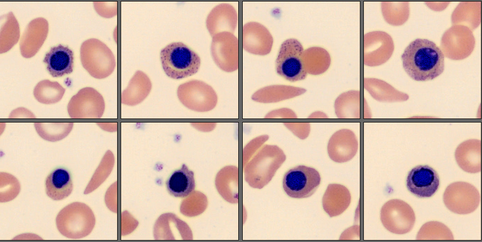 NRBC patient case 9