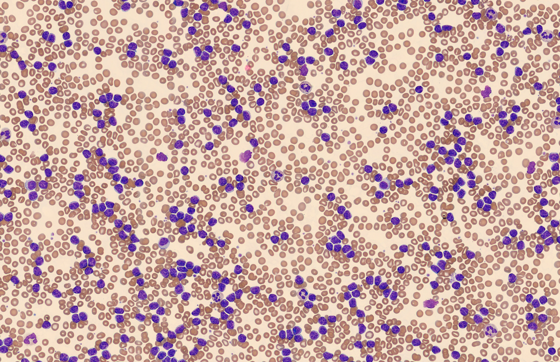 RBC from CellaVision Monthly Cell Challenge May 2025