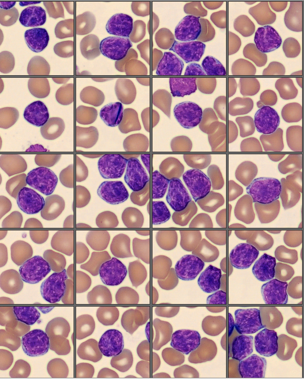 Lymphocytes from the CellaVision Monthly cell challenge May 2025