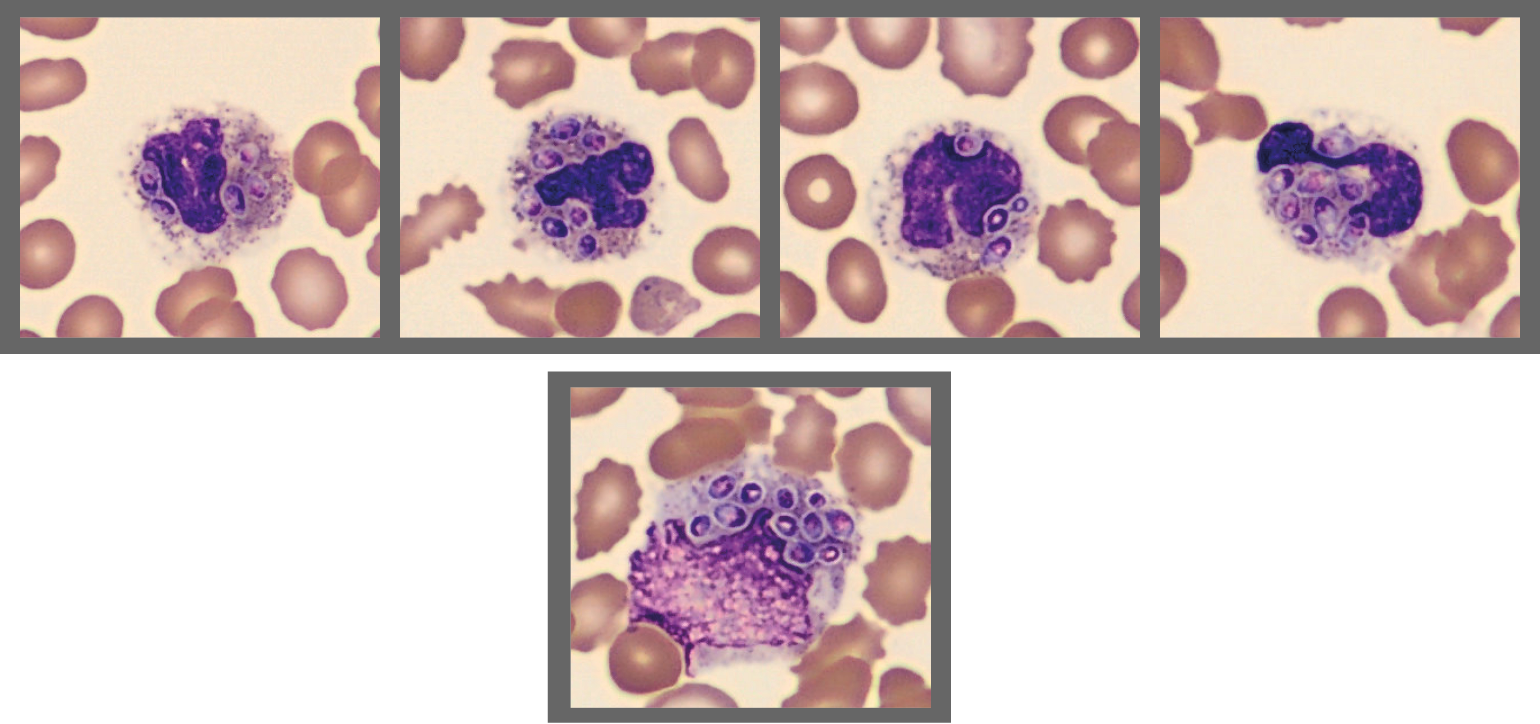 Cells from CellaVision Monthly cell challenge July 2025