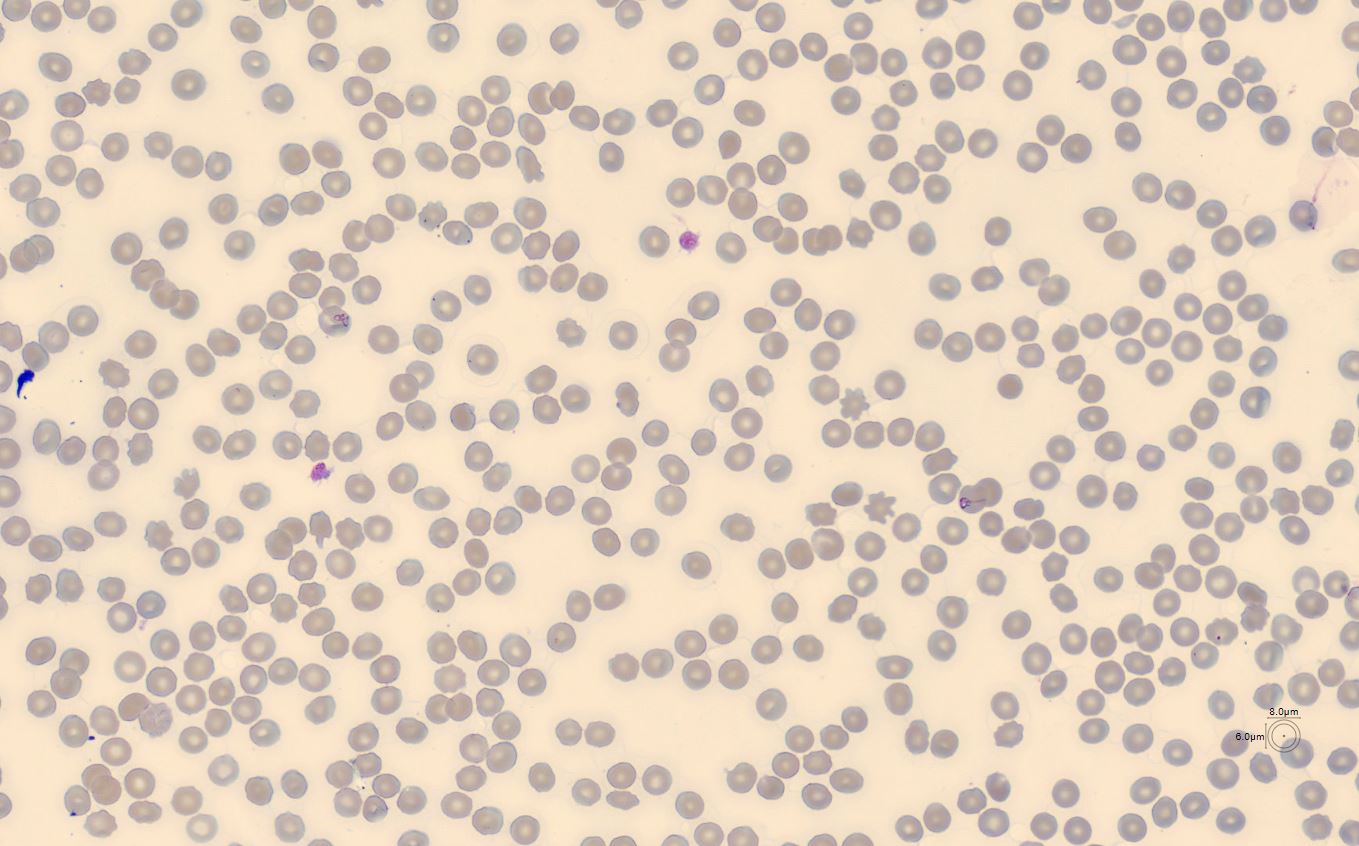 RBC CellaVision Monthly Cell Challenge August 2025