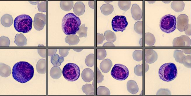 Lymphocytes from the CellaVision Monthly cell challenge August 2025