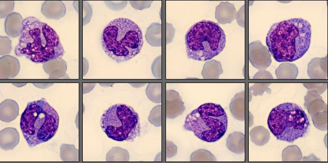 Monocytes CellaVision Monthly Cell Challenge August 2025