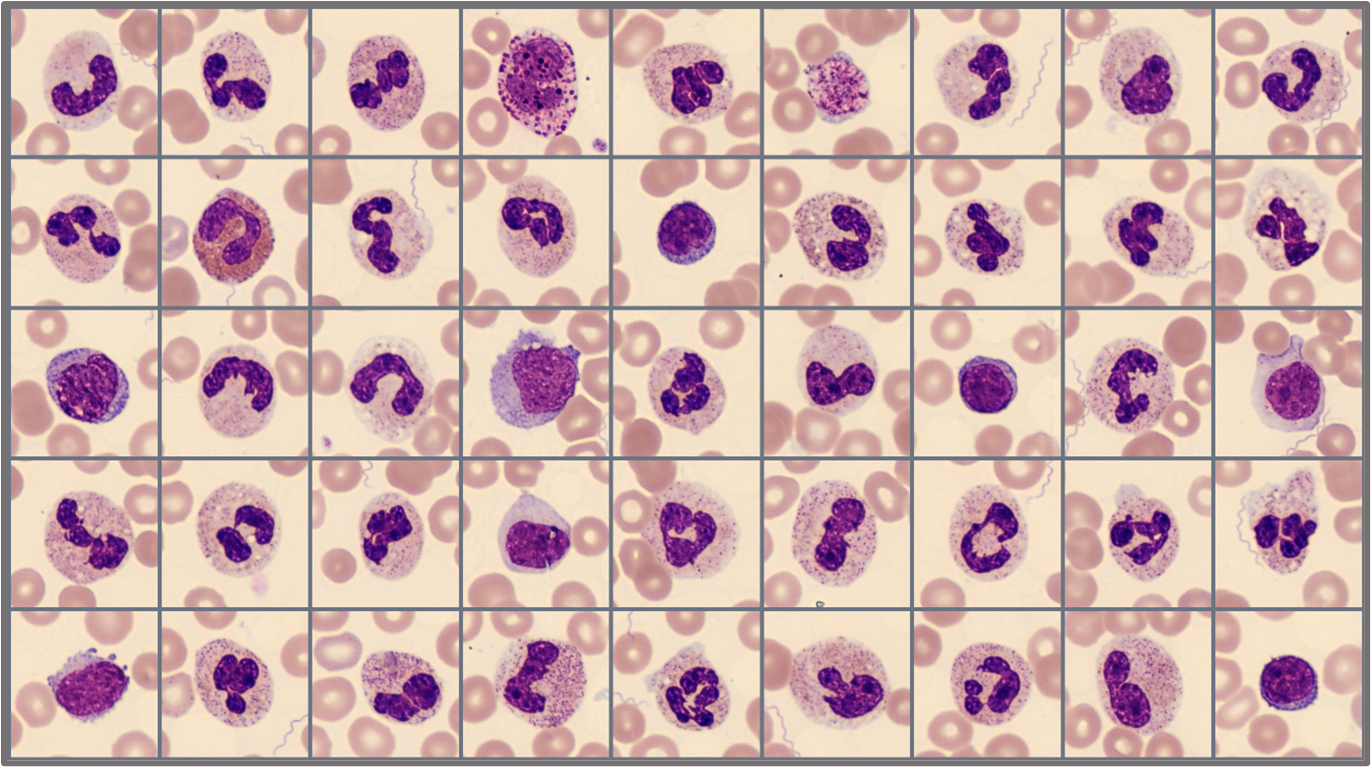 Sample of cells classified in the Global test 2025:2