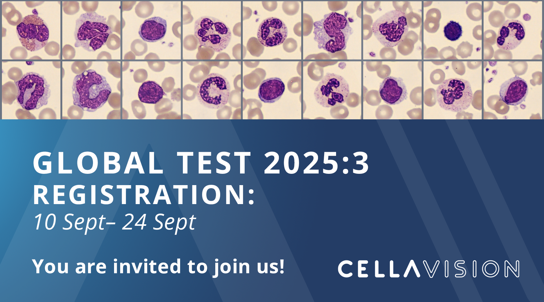 Global test 2025:3
