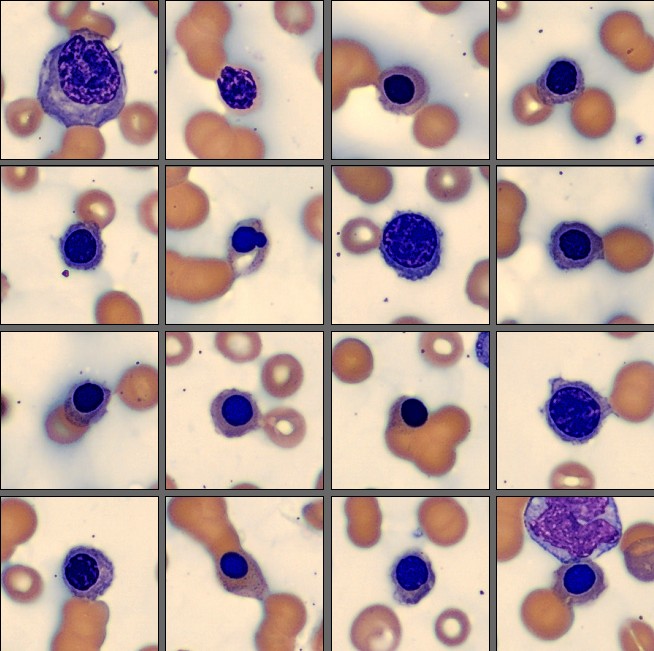 NRBC Monthly Cell Challenge September 2025