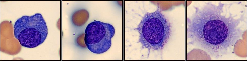 Plasma cells Monthly Cell Challenge September 2024