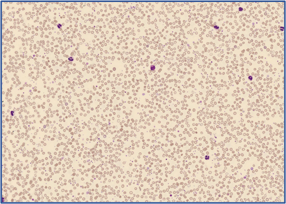 RBC Overview Global Test 2025:3