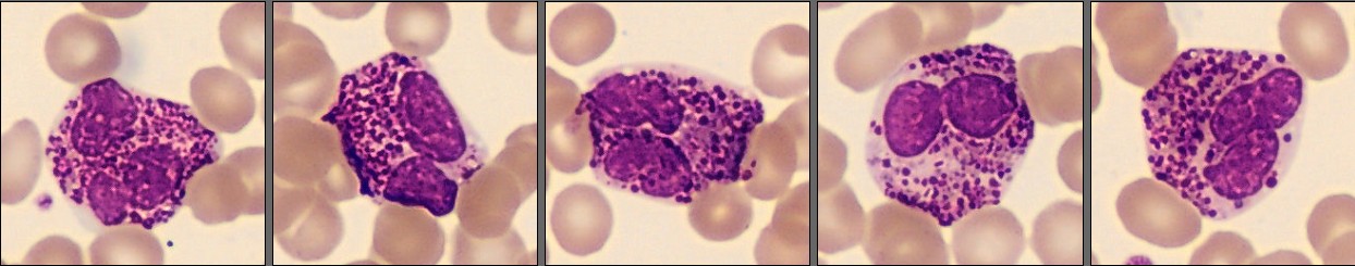 Basophils from the Monthly Cell Challenge December 2025