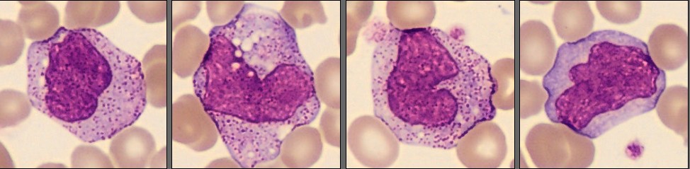 Monocytes from the CellaVision Monthly Cell Challenge December 2025