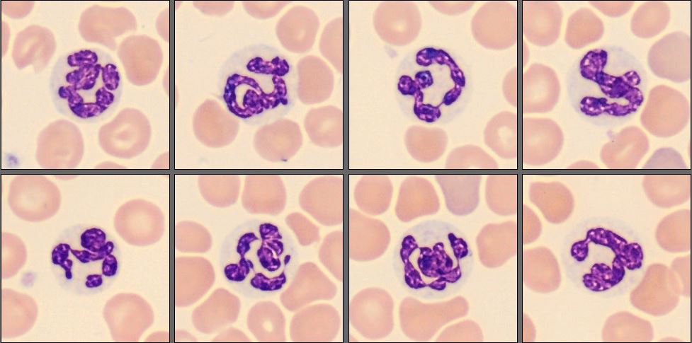 Neutrophils from the CellaVision Monthly Cell Challenge November 2025