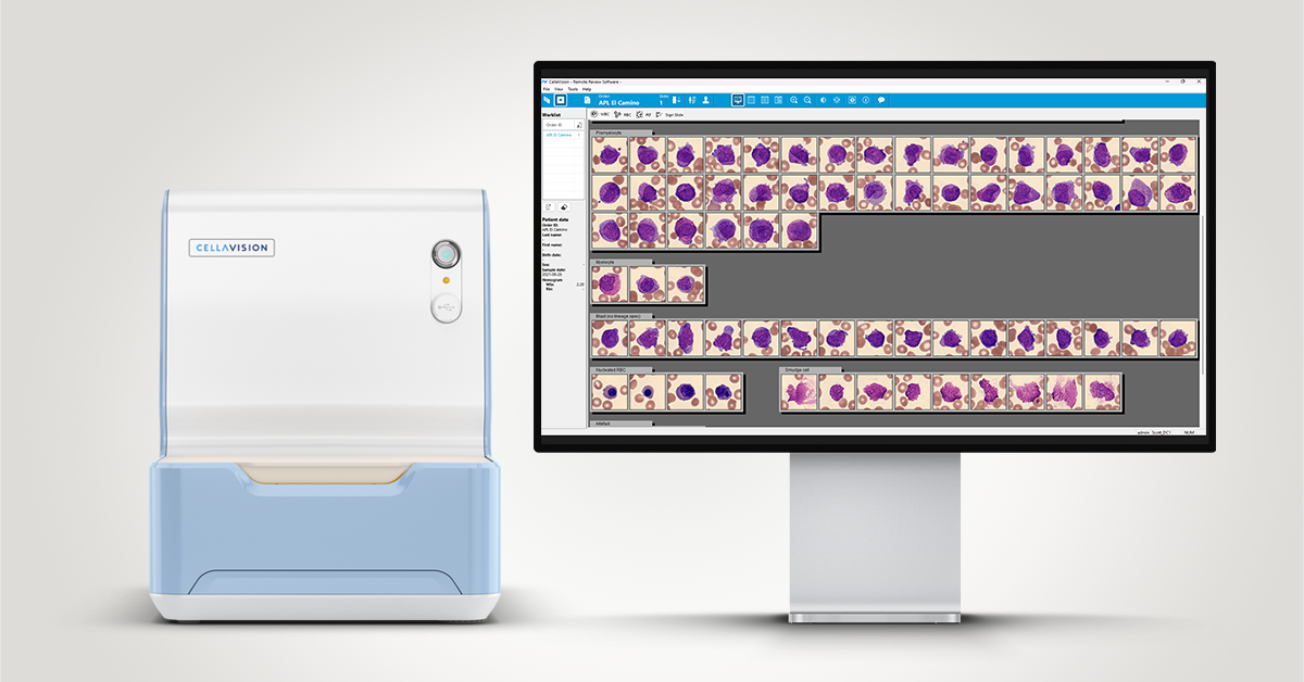 CellaVision Patient Case #11