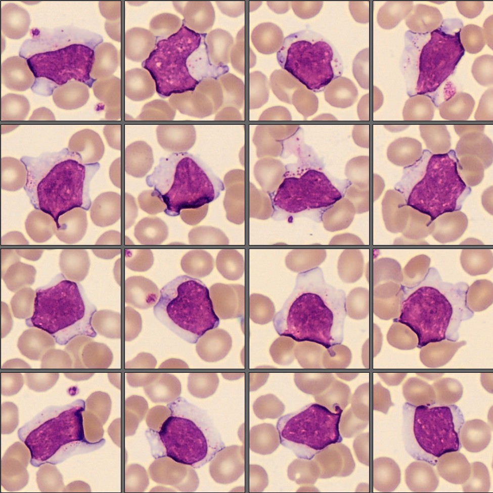 Lymphocytes from the CellaVision Monthly cell challenge December 2025