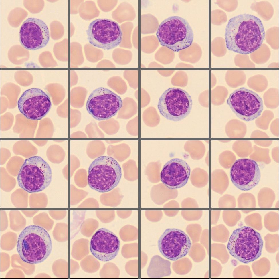 Lymphocytes from the CellaVision Monthly cell challenge November 2025