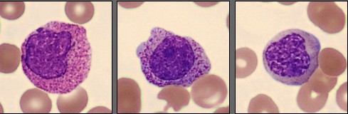 Myelocytes from CellaVision Patient Case 4 2025