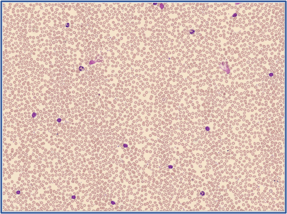 RBC overview Global Test 2025:4