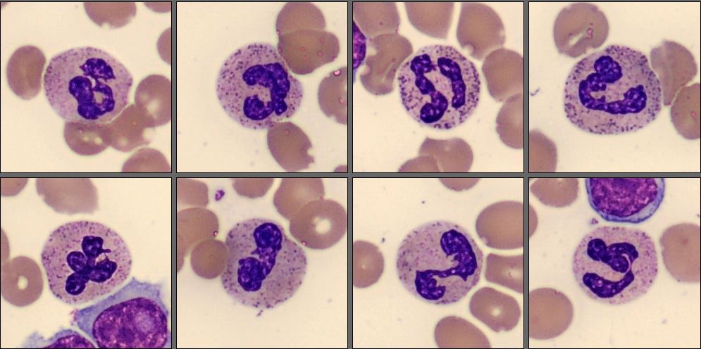 Neutrophils Monthly Cell Challenge January 2026