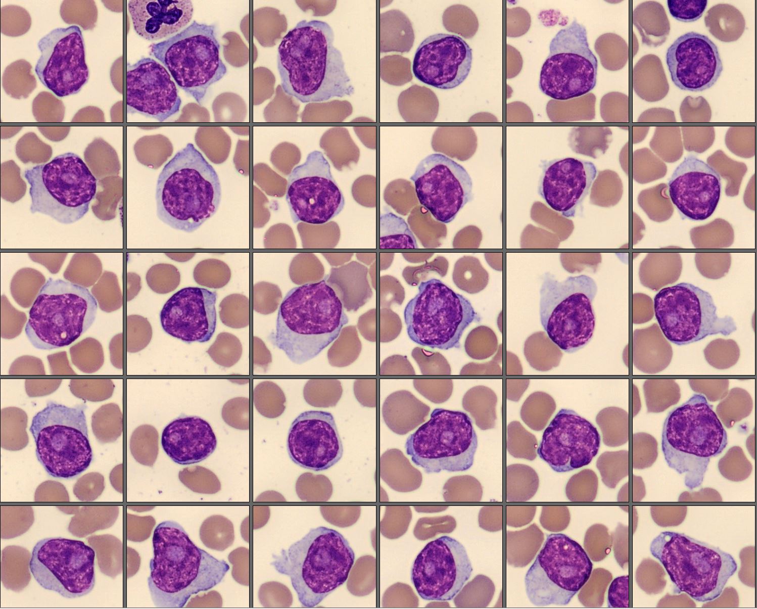 CellaVision Monthly Cell Challenge January 2026