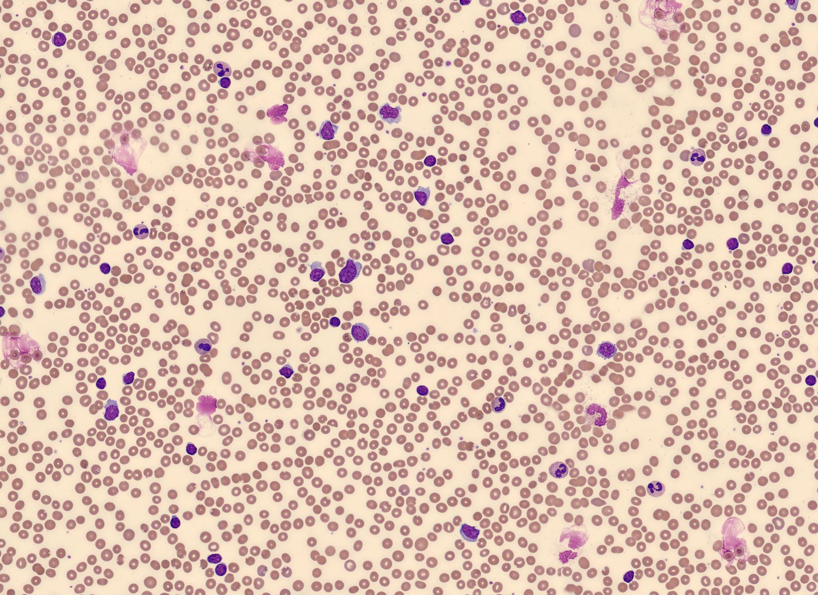 RBC Overview CellaVision Monthly Cell Challenge January 2026