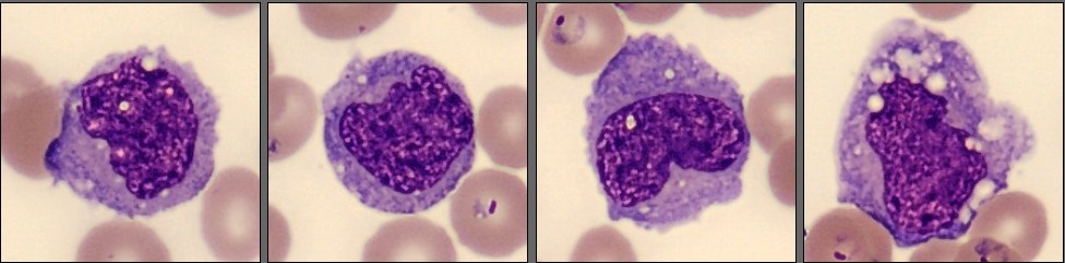 Monocytes, monthly cell challenge February 2026