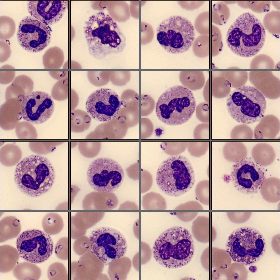 Neutrophils, monthly cell challenge February 2026