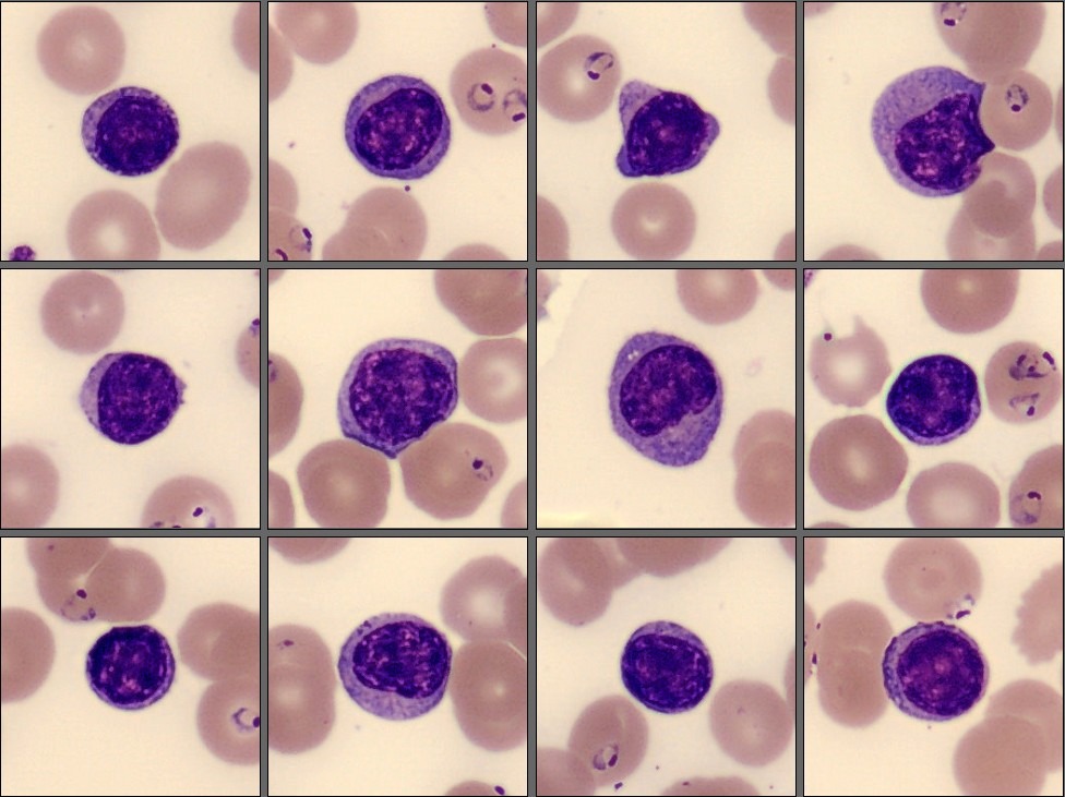 Lymphocytes, monthly cell challenge February 2026