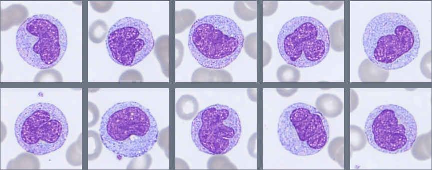 Monthly Cell Challenge #3 2026 monocytes